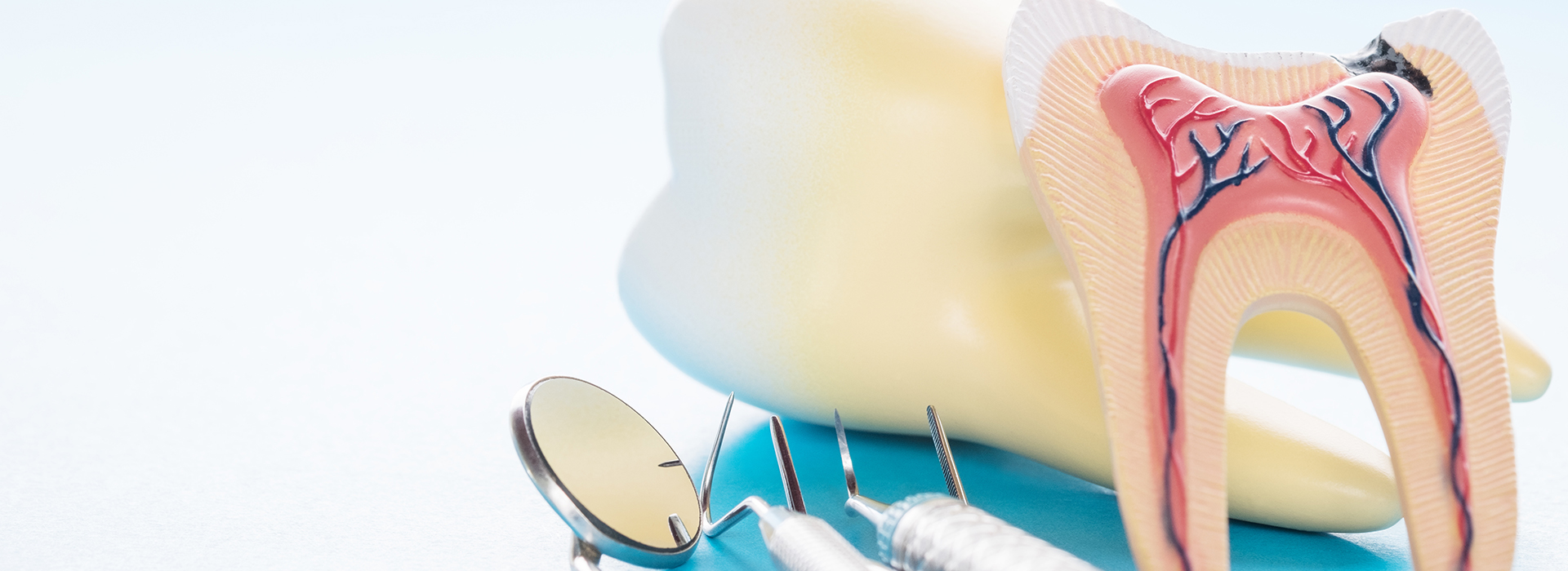 Root Canal Therapy in Glen Cove