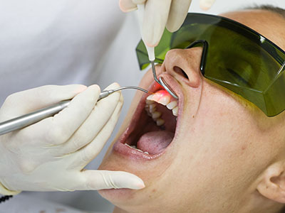 LANAP Dentist in Glen Cove